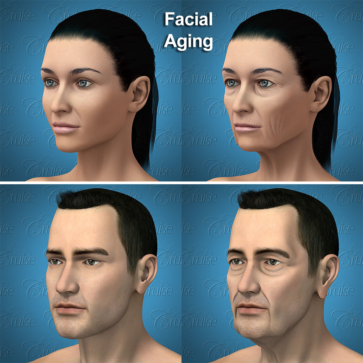 Facial aging